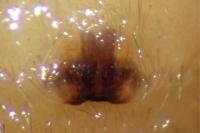 Clubiona phragmitis