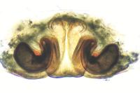 Diplocephalus graecus