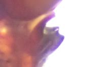 Philodromus pinetorum