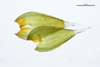 Hedwigia ciliata