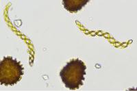 Fossombronia pusilla