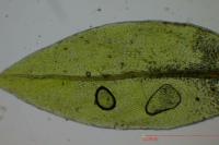 Ptychostomum pseudotriquetrum