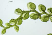Microlejeunea ulicina