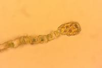 Ptychostomum donianum