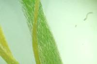 Oxalis dillenii