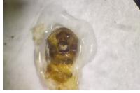 Emblethis denticollis