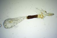 Pseudoswammerdamia combinella