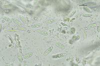 Lecania rabenhorstii
