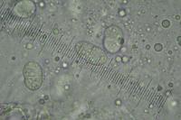 Lichenochora galligena