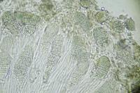 Phlyctis agelaea