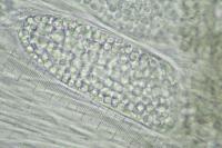 Phlyctis agelaea