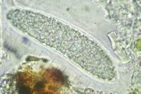 Pertusaria pustulata