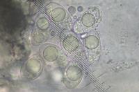 Verrucaria muralis