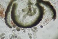 Muellerella lichenicola