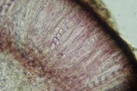 Tephromela atra var. torulosa