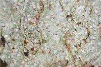 Lecanora albella