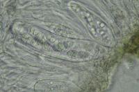 Arthopyrenia analepta