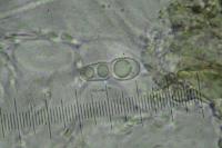 Arthopyrenia analepta