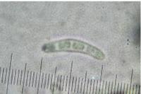 Pseudoschismatomma rufescens