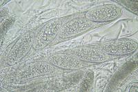 Pertusaria leioplaca