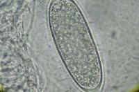 Pertusaria leioplaca