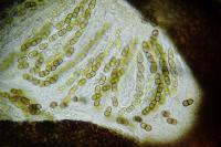 Didymocyrtis slaptoniensis