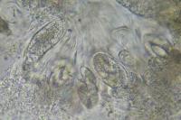 Telogalla olivieri