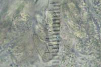 Telogalla olivieri