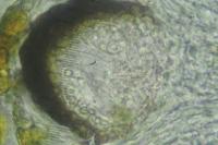 Stigmidium squamariae