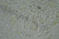 Stigmidium squamariae