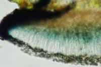 Catillaria chalybeia