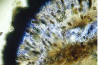 Diplotomma chlorophaeum