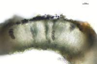 Diplotomma pharcidium