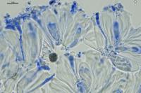 Lecania cyrtella