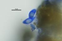Protoblastenia rupestris