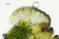 Scoliciosporum umbrinum var. umbrinum