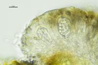 Scoliciosporum umbrinum var. umbrinum