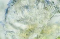 Scoliciosporum umbrinum var. umbrinum