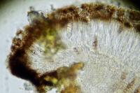 Melaspilea enteroleuca