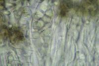 Melaspilea enteroleuca
