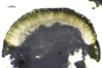 Aspicilia contorta