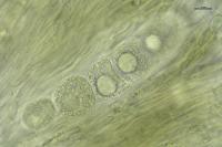 Aspicilia contorta