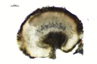 Lecidella stigmatea