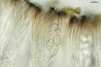 Lecidella stigmatea