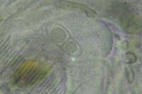 Arthonia didyma