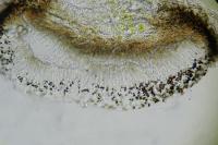 Catillaria nigroclavata