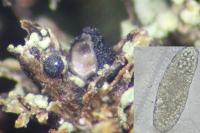 Agonimia tristicula