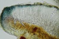 Lecidella elaeochroma