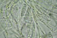 Gyalecta truncigena