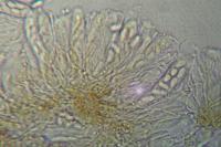 Placynthiella icmalea